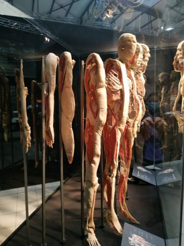 Wystawa BODY WORLDS – VITAL